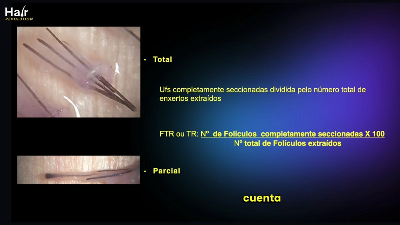 Diapositiva de la clase: folículos extraídos vistos al microscopio